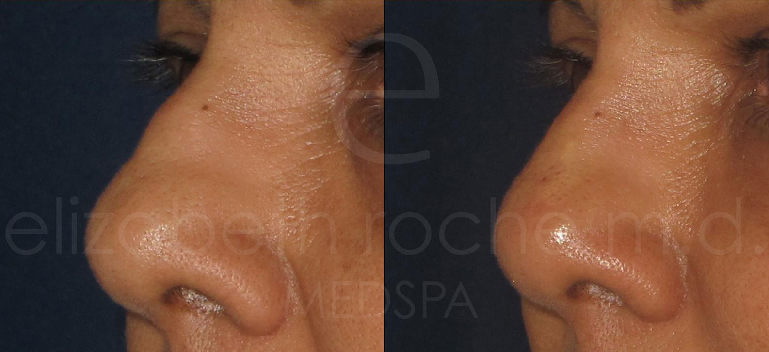 nose-wm