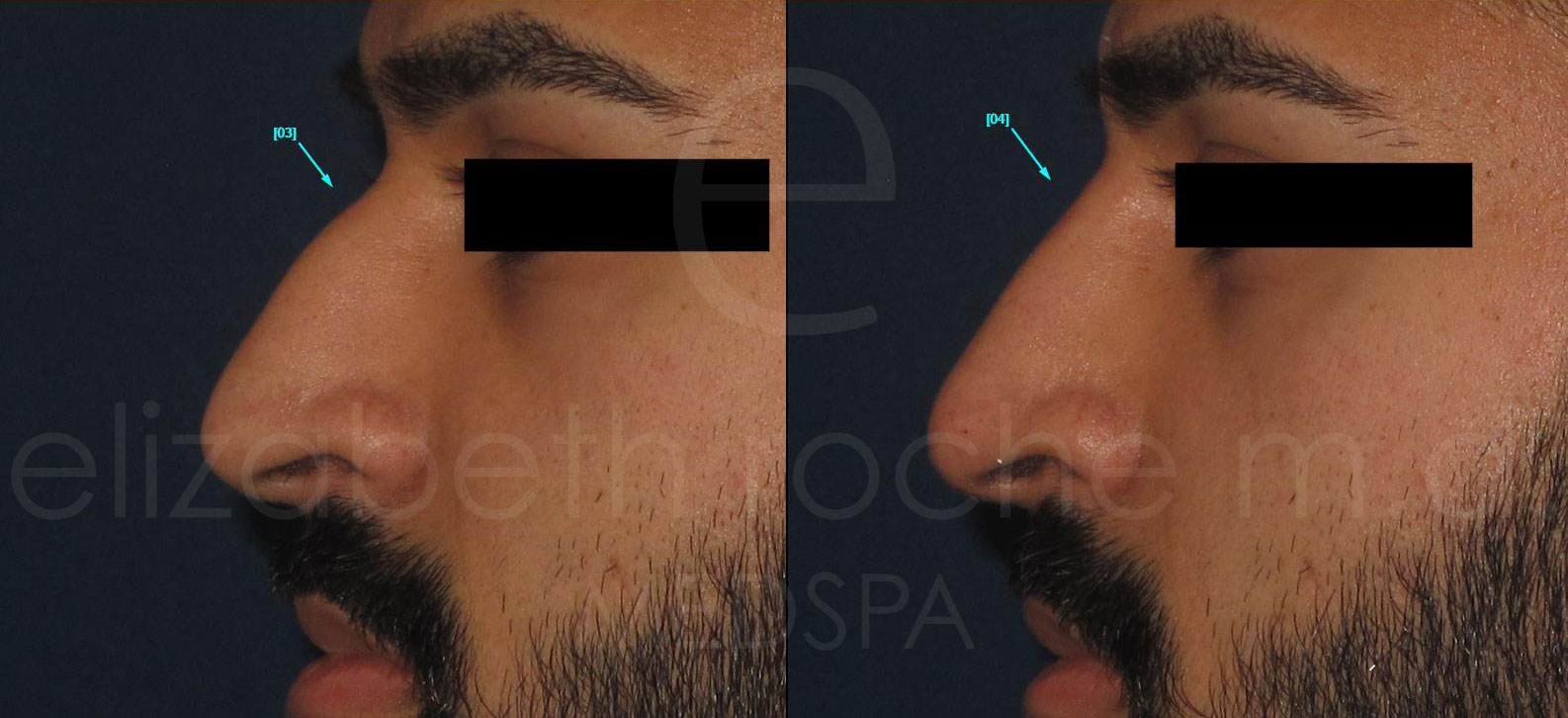 nose2-wm