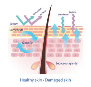 damaged skin barrier